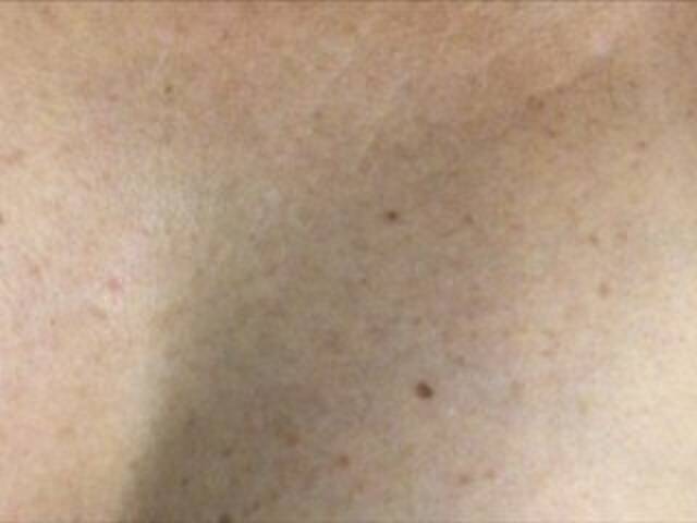 Ringhäälingupildid Alianakiss