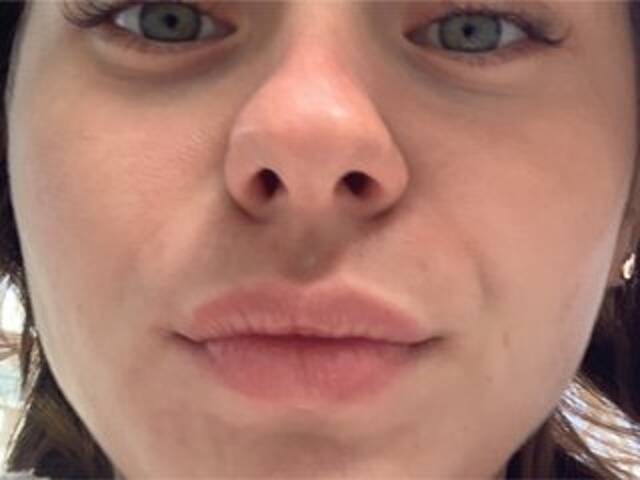 Ringhäälingupildid -KARAMELKA-