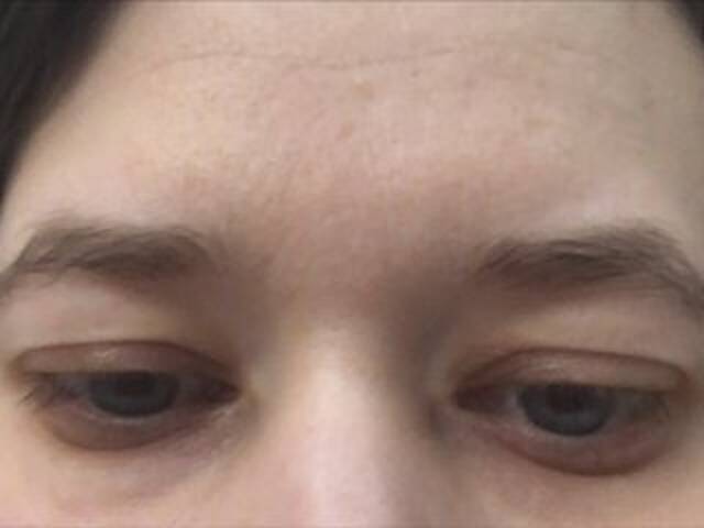 Ringhäälingupildid Lorena_25