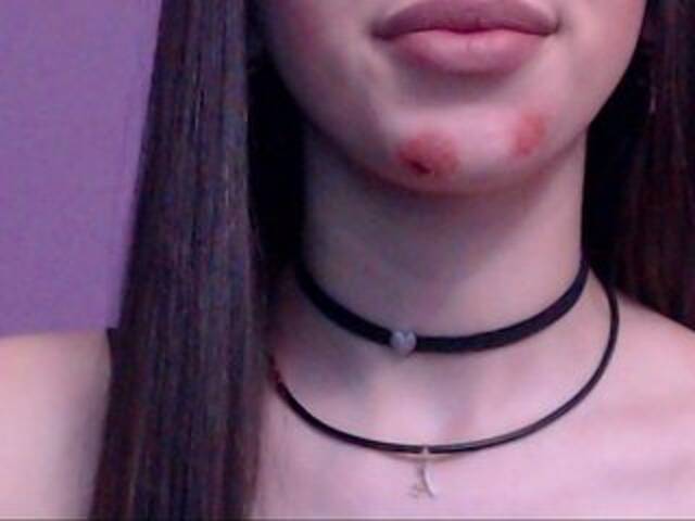 Ringhäälingupildid Madellyn