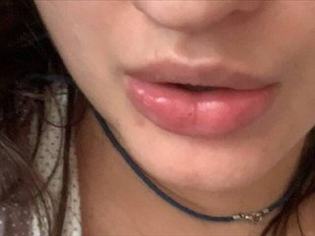 Ringhäälingupildid Rinaru555555